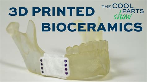  Biocermet – Eine Revolutionäre Kombination Für Implantate Und Knochenersatzmaterialien?!