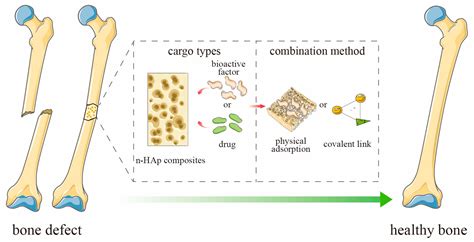 NanoHydroxyapatite:  Ein Wundermaterial für Oste Implantate und Geweberegeneration?